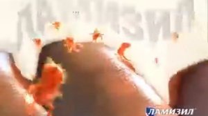 Реклама Ламизил  Ламизил беспощаден ко всем видам грибка стопы