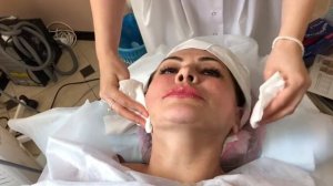 Ультразвуковой SMAS лифтинг на аппарате Ultraformer | ДО и ПОСЛЕ процедуры Ультраформер