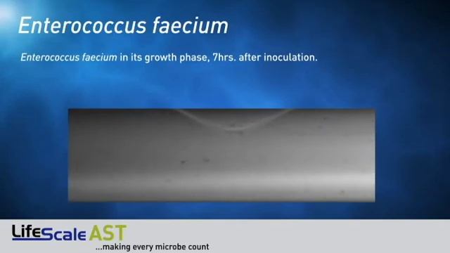 Enterococcus faecium смотреть онлайн