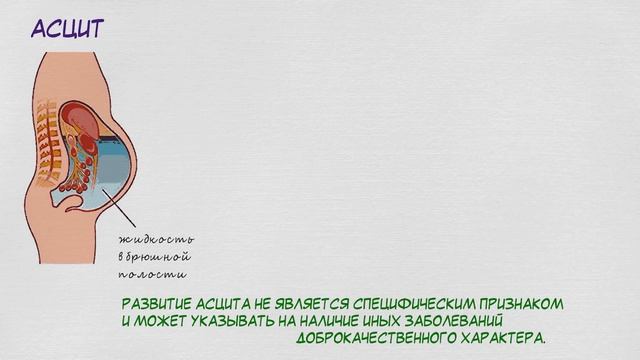 Важно каждой женщине знать эти симптомы рака яичников! смотреть онлайн