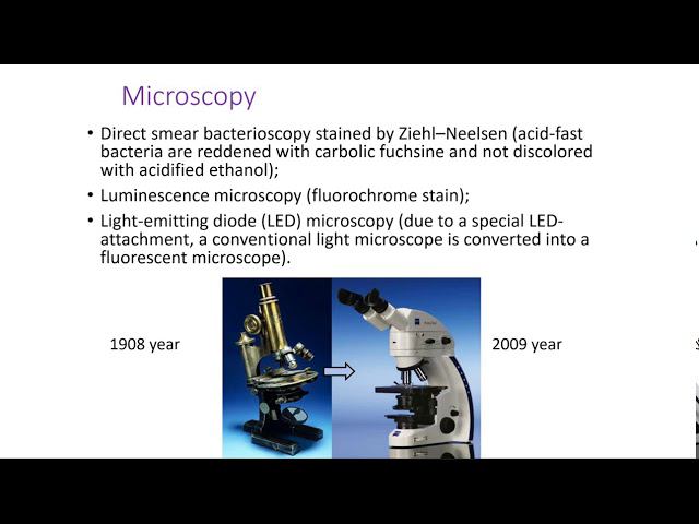 Ethiological TB Diagnosis