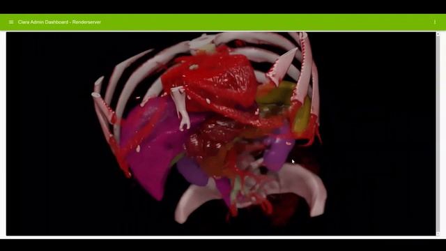 NVIDIA Holoscan: AI Computing for Medical Devices смотреть онлайн