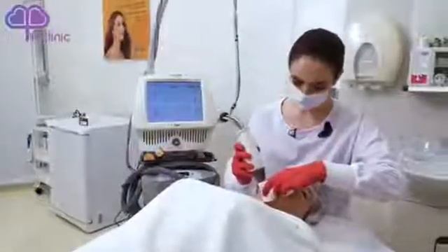 Как проходит процедура Фраксель (Fraxel)