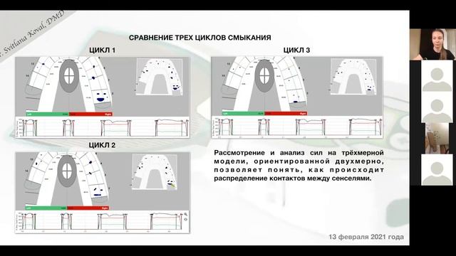 Свойства датчика Т скан. Как работает анализ окклюзии Т-скан? смотреть онлайн