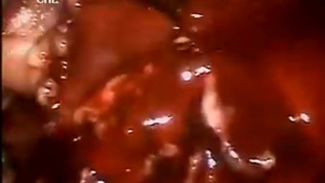 видеоряд карбункул смотреть онлайн