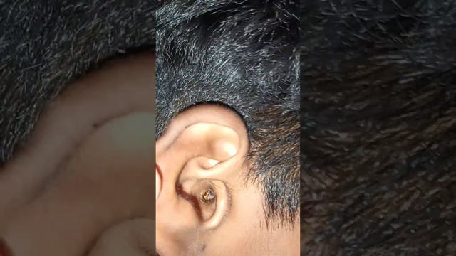 How To Remove Insect