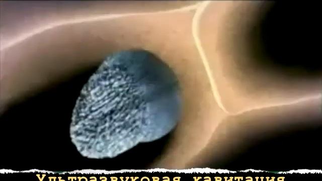 Ультразвуковая Кавитация.avi смотреть онлайн