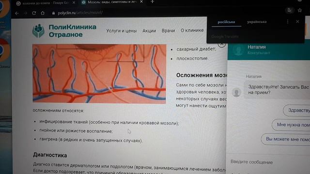 Мозолі на ногах, профілактика, власний досвід. смотреть онлайн