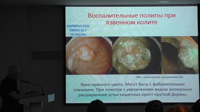 03 Корнеев АА Экспертная эндоскопическая диагностика ВЗК смотреть онлайн