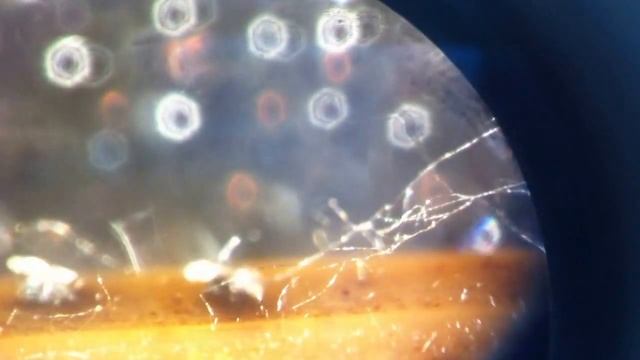 Germinacion conidias de peritecio смотреть онлайн