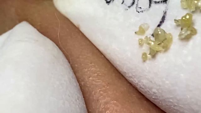 Enjoy Every Day With The Best Video Loan Nguyen Spa Official  2641