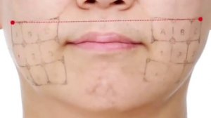 РФ лифтинг без прекрас. Только опыт и факты