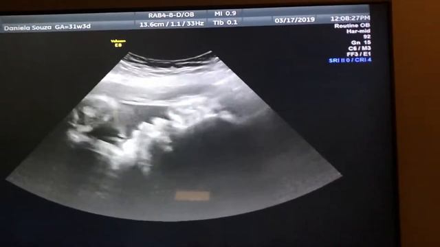 Ultrassom 4D - Primeira vez que vimos o Rostinho da Alyssa смотреть онлайн