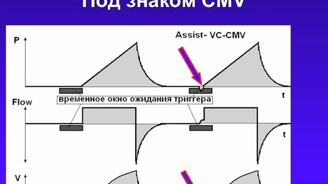 Режимы ИВЛ 3. Согласование вдохов и паттерны ИВЛ