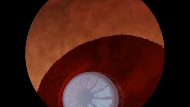 Зрение превью смотреть онлайн