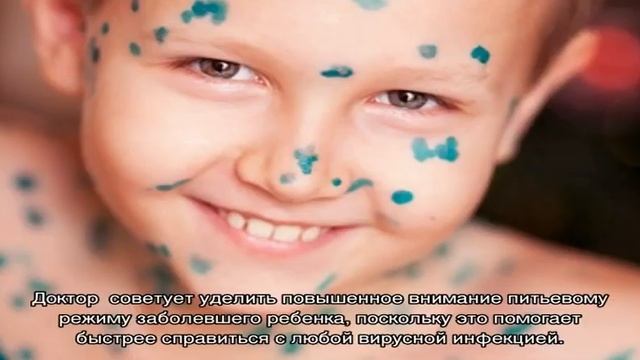 Как начинается ветрянка: первые признаки смотреть онлайн
