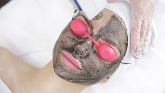 Лазерный карбоновый пилинг смотреть онлайн