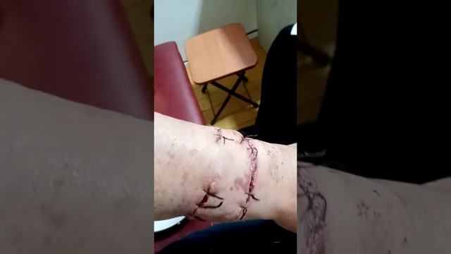 После укуса алабая, во время кормление укусил хозяина смотреть онлайн
