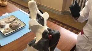 Общий обзор головного мозга, производные мозговых пузырей. Оболочки головного мо