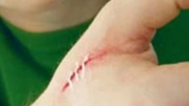 JAROHATDAN KEYINGI TERIDAGI CHANDIQ, JAROHAT HAQIDA! Нодир Абдусамад (Алимов)