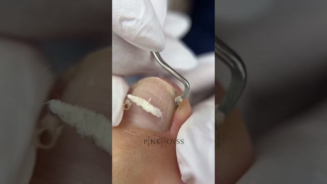 Пенка для педикюра Пинк ройс купить в описании смотреть онлайн