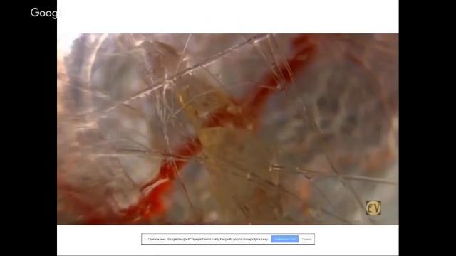 Как избавиться от боли в спине, мышцах и суставах смотреть онлайн