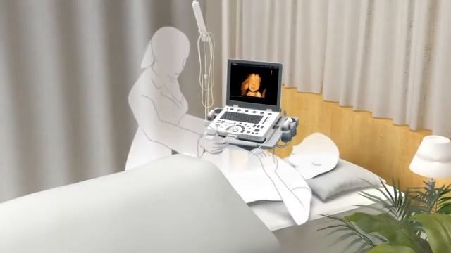 MySono U6 - переносной УЗИ аппарат среднего класса от Самсунг Медисон | uzimir.ru смотреть онлайн