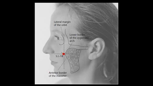 IG18 Цюань-ляо смотреть онлайн