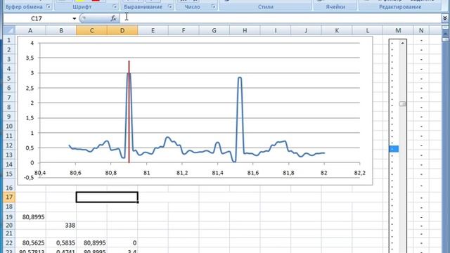 Manipulation ECG in MS Excel (Обработка ЭКГ в MS Excel) смотреть онлайн