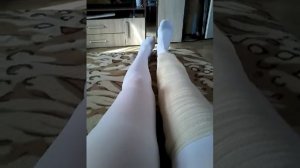 Импрессионный перелом мыщелка большеберцовой кости без смещения отломков. Часть 3