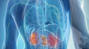 БУЙРАК ОҒРИҒИ САБАБЛАРИ.BUYRAK OG'RIG'I SABABLARI,