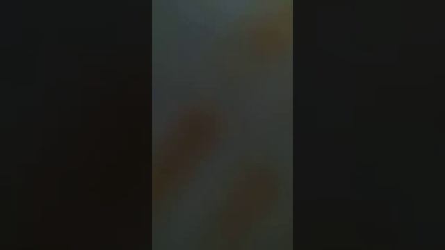 Пластыри для лечения варикозного расширения вен васкулит смотреть онлайн