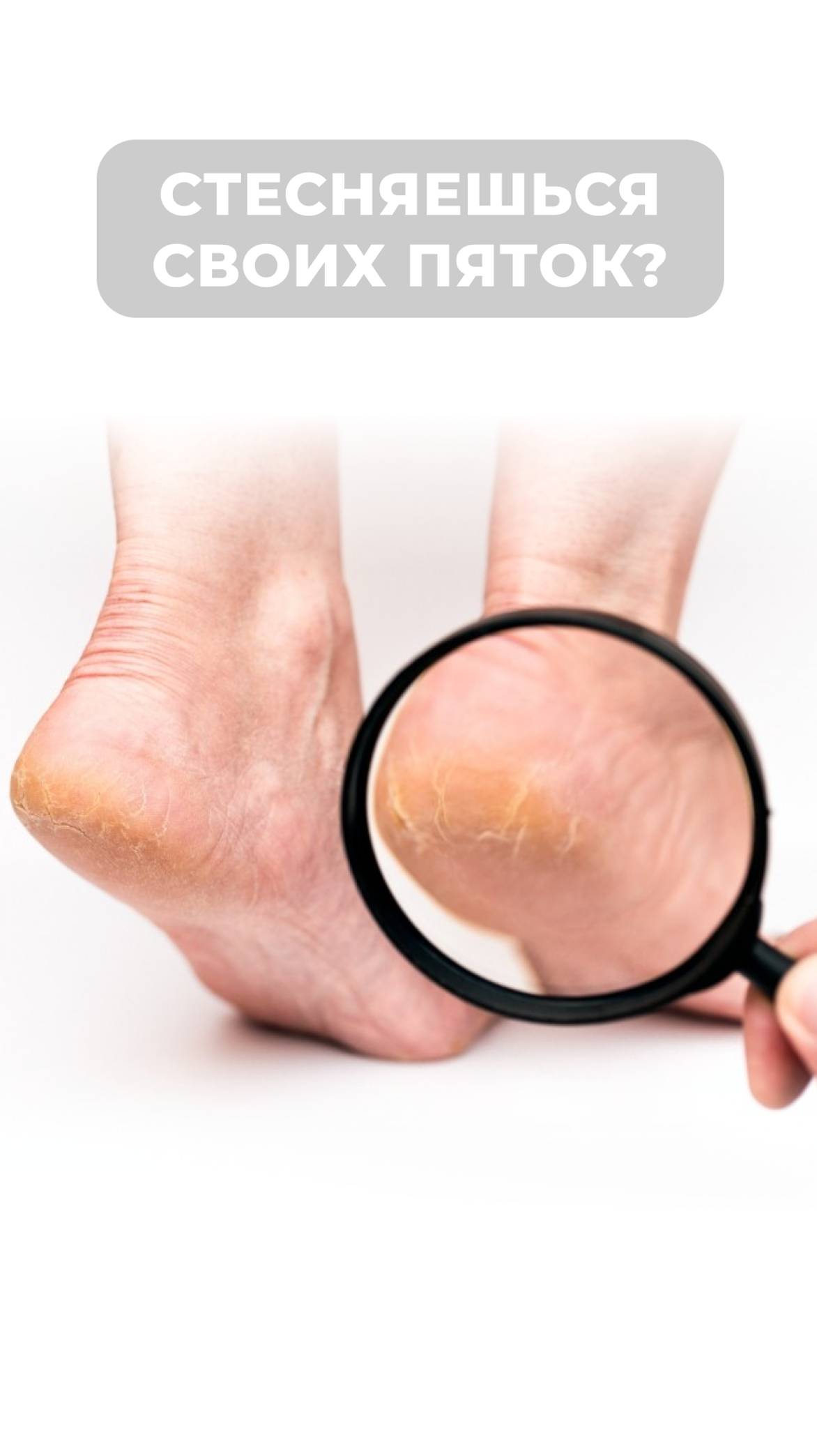 Стесняешься своих пяток? Я знаю как тебе помочь! Переходи в описание 💗