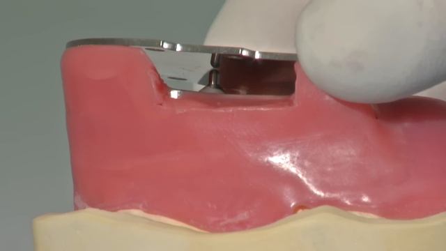 Candulor Registration Set CRS 10