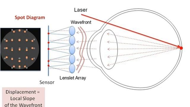 Shack–Hartmann wavefront sensor | Wikipedia audio article смотреть онлайн