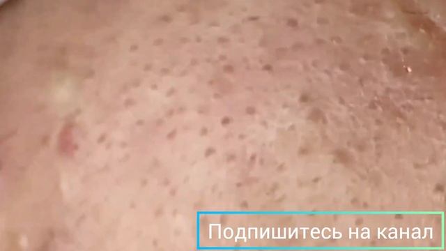 Чёрные точки ? Black dots смотреть онлайн