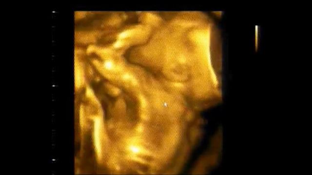 3D УЗИ в Клинике "Медицина и Красота на Павелецкой" смотреть онлайн
