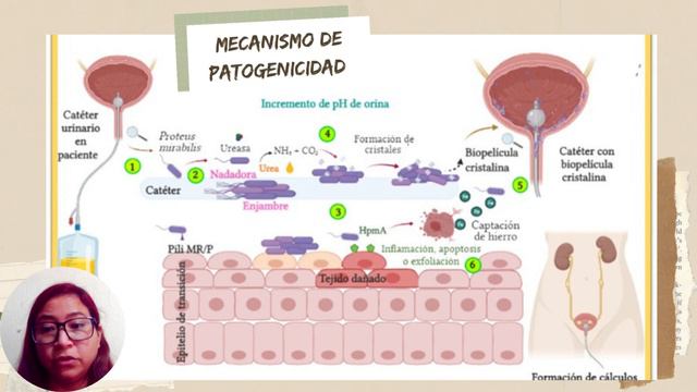 Proteus Mirabilis смотреть онлайн