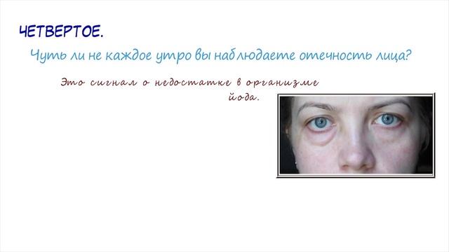 8 Проблем Со Здоровьем, Которые Скрывает Лицо! Ресницы, глаза, отечность, цвет кожи в области... смотреть онлайн