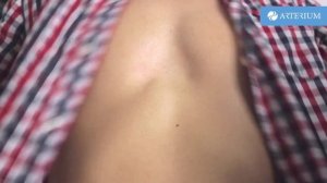 Искусственный массаж сердца. Первая помощь при остановке сердца