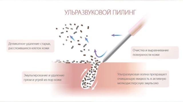 УЛЬТРАЗВУКОВАЯ ЧИСТКА ЛИЦА ? DOCTOR COMFORT US-4 смотреть онлайн