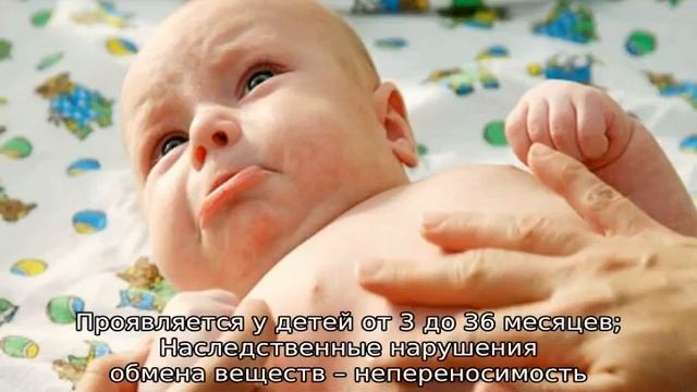 Ребенка рвет после еды — почему возникает рефлекс смотреть онлайн