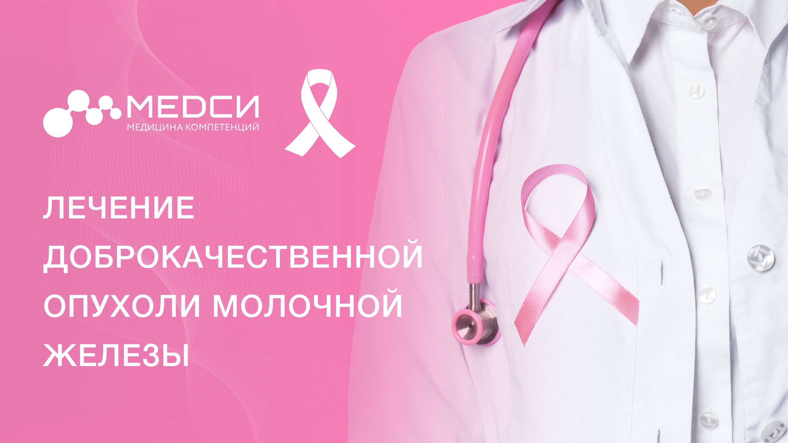 Доброкачественные новообразования груди: фиброаденомы, кисты, уплотнения, внутрипротоковые папилломы смотреть онлайн