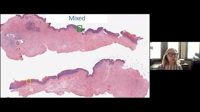 GUPS Virtual Education Series: GU Pathology Educational Updates 8-1-2022 смотреть онлайн