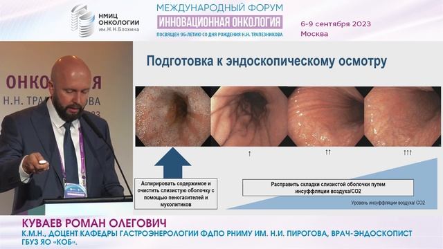 Стандарты и новые технологии в диагностике фоновых заболеваний желудка_Куваев Р.О. смотреть онлайн