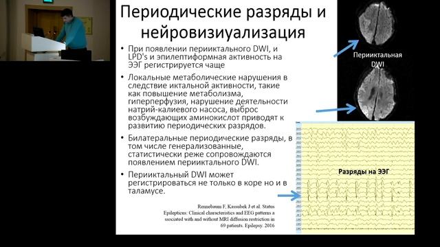 Сложные вопросы ведения пациентов с эпилептическим статусом Подлепич В.В. смотреть онлайн