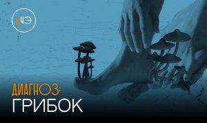 Грибок стопы и ногтей | Диагноз