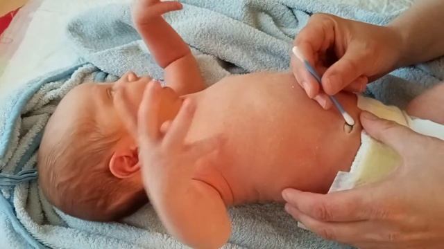 Обработка пупочной ранки новорожденного смотреть онлайн