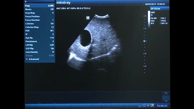 УЗИ АППАРАТ MINDRAY DP-50 смотреть онлайн