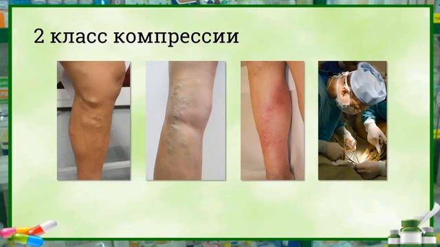 Как подобрать покупателю компрессионный трикотаж? смотреть онлайн